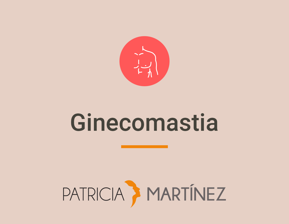 ginecomastia