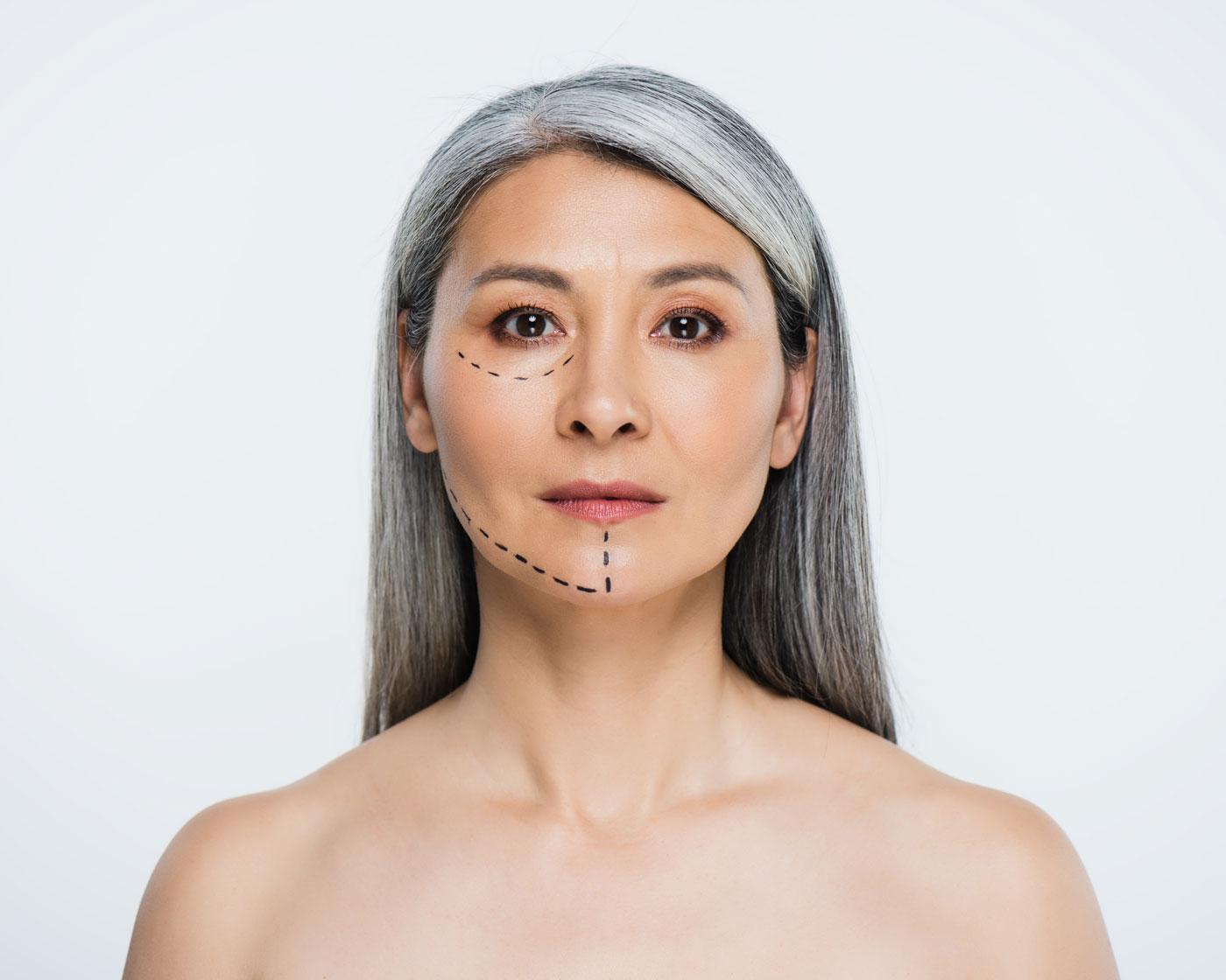 escultura facial y lifting